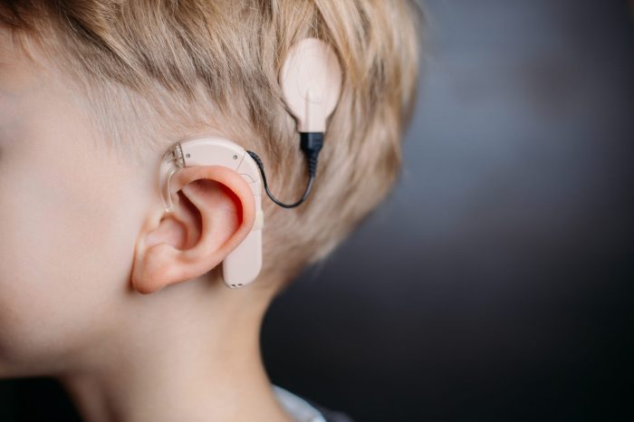 What insurance companies cover cochlear implants